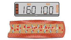 这根血管连通大脑最容易堵!很多人半身不遂后才发现!不看后悔!