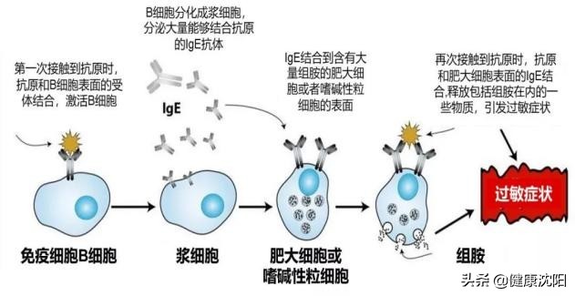 了解过敏性结膜炎的症状和治疗,饱受过敏性结膜炎的困扰