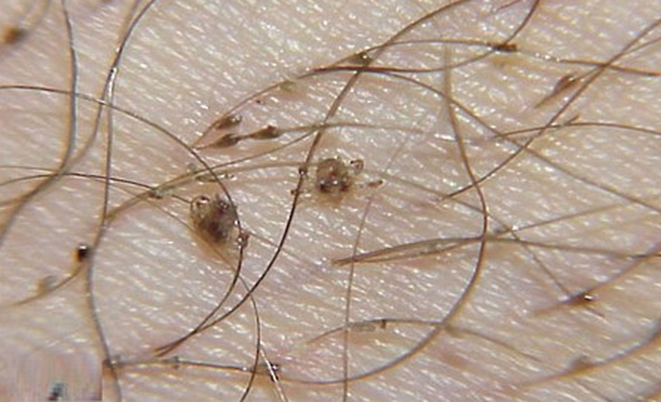 男子下体出现红疹瘙痒,男子下体瘙痒看什么科