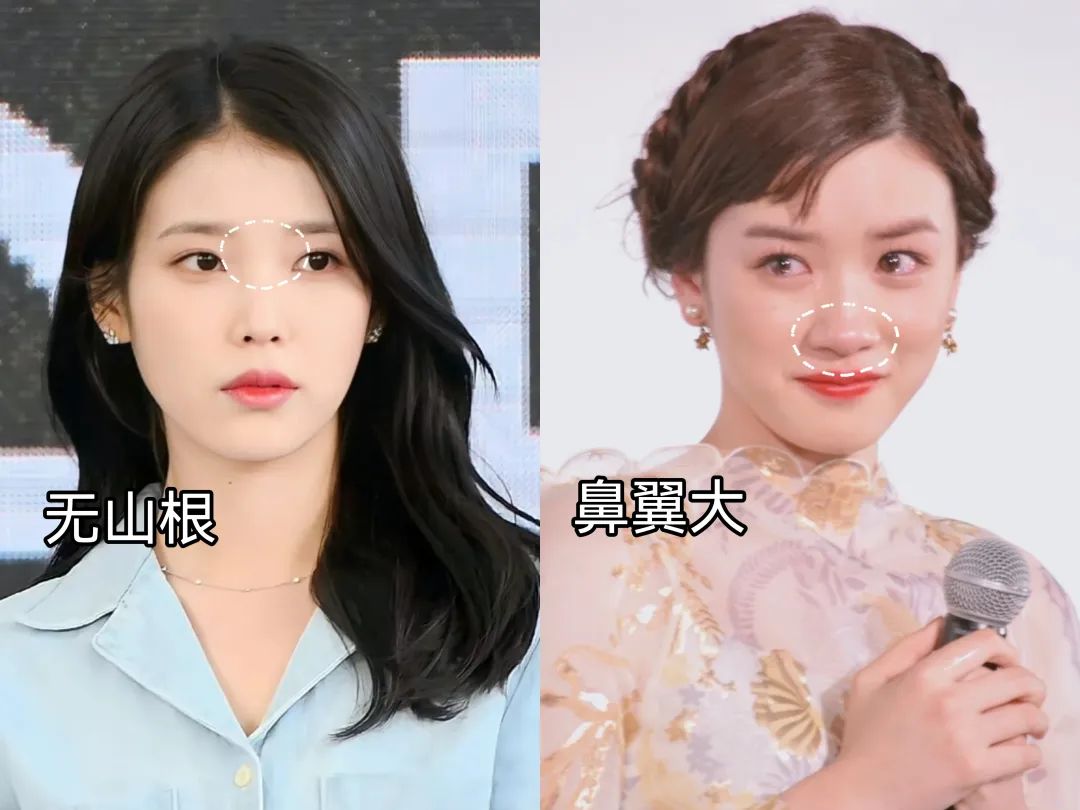 塌鼻子正脸好看,塌鼻子该如何变美啊