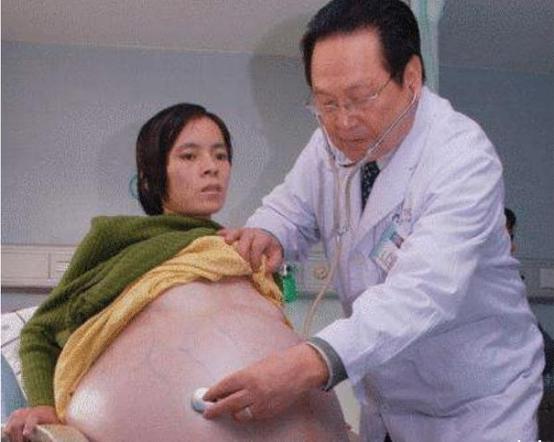 徐克成癌症新思路,徐克成谈癌症克星