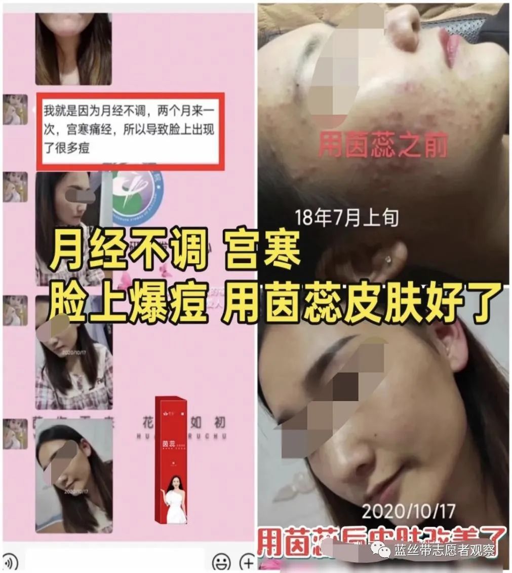 广州丽仕生物旗下茵蕊抑菌凝胶治疗妇科疾病？四级代理涉嫌违法