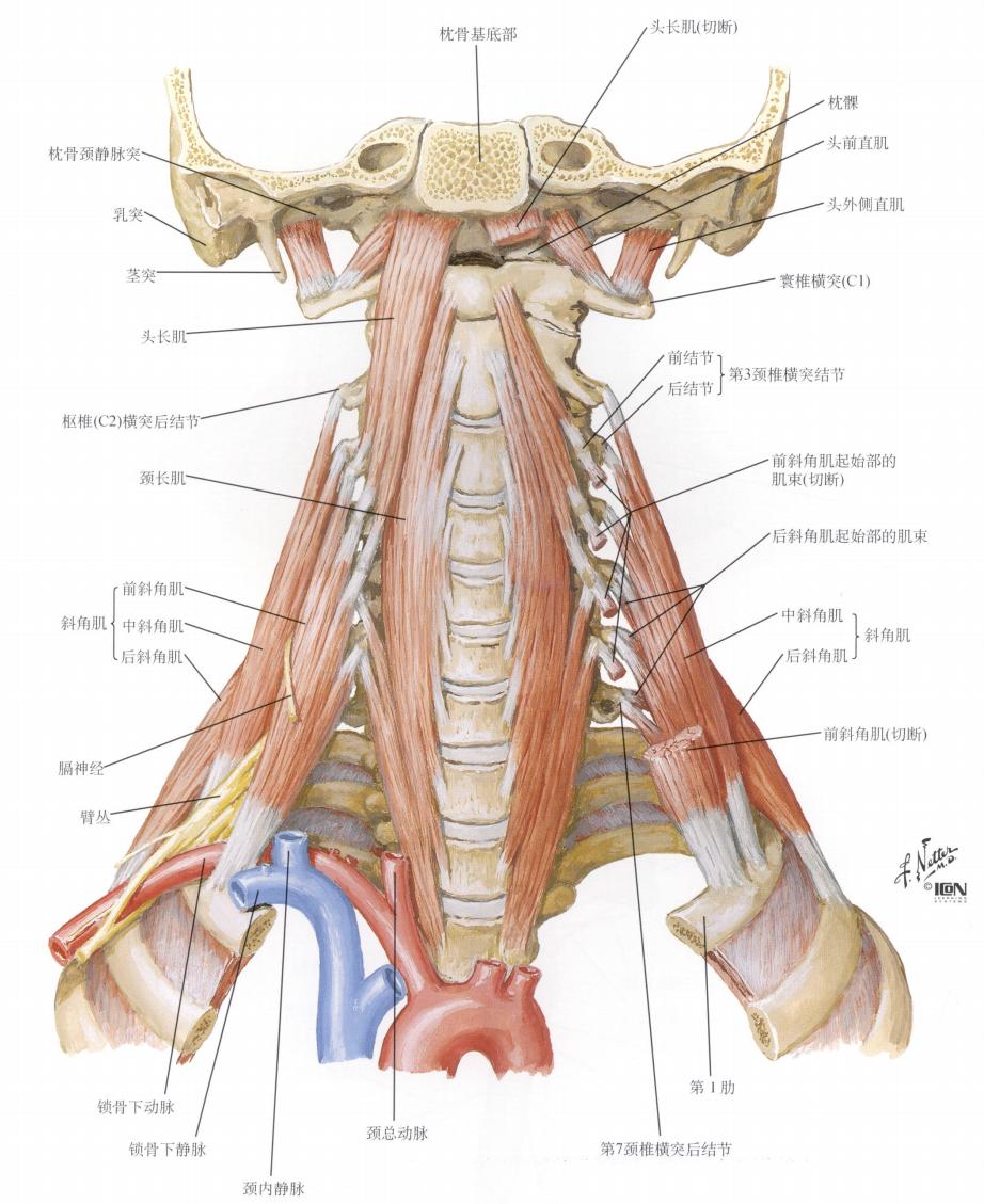 颈长肌腱炎影像表现,三头肌钙化性肌腱炎治疗