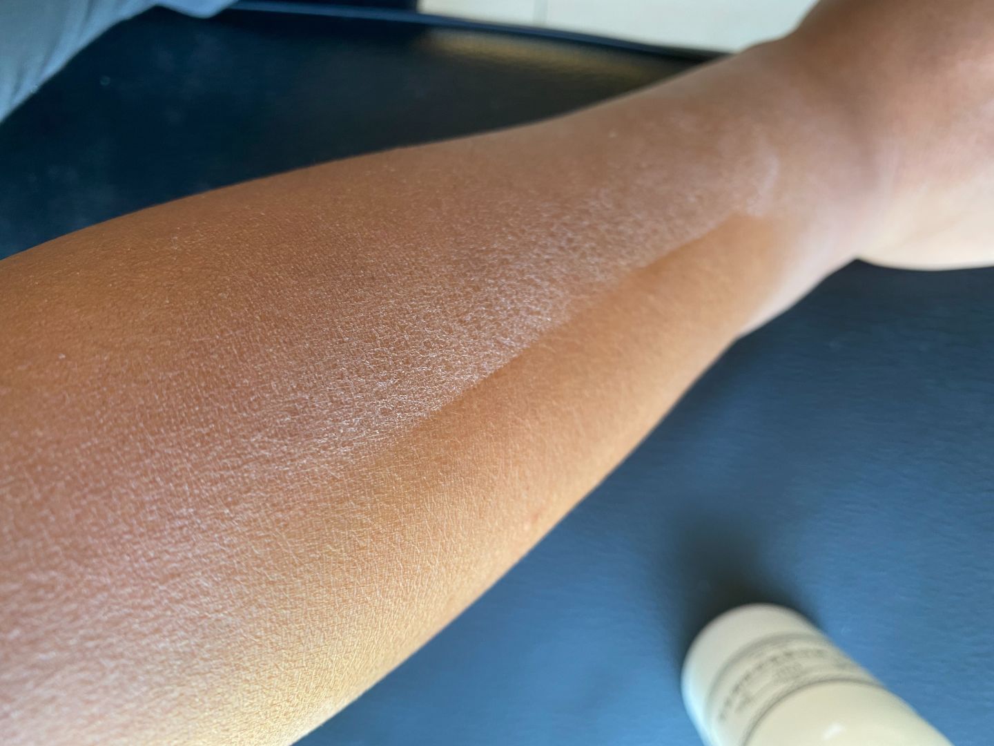 男生脸上很多处脱皮怎么办,男生脸上脱皮干燥