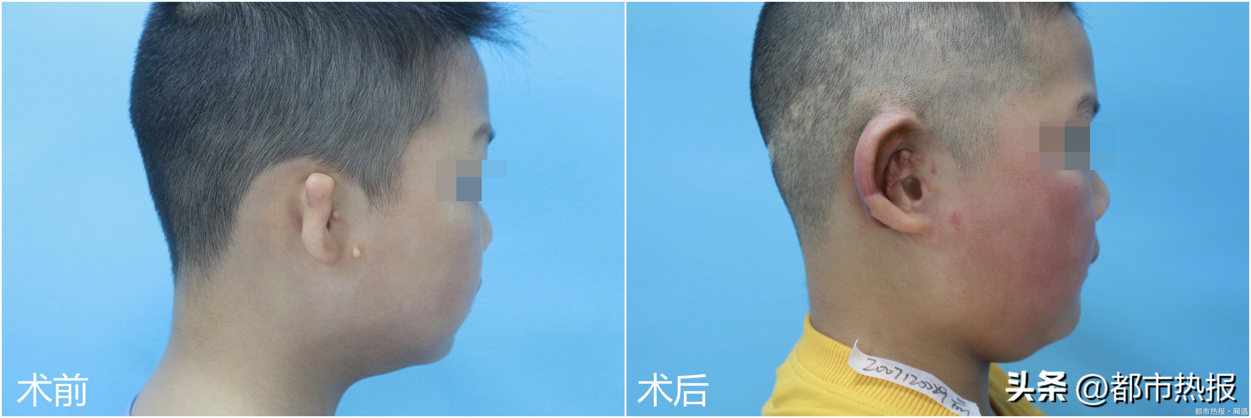 重庆华美整形美容医院项目,重庆华美专科整形医院