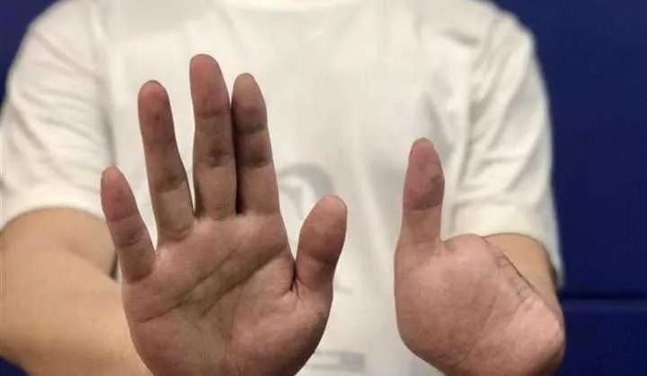 缅北：没有高薪，没有公主，充斥*力暴**，诈骗和死亡，堪比地狱