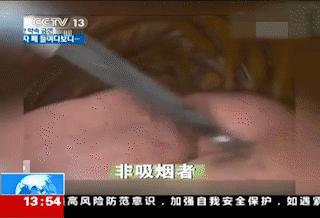 别让香烟害了你一生!