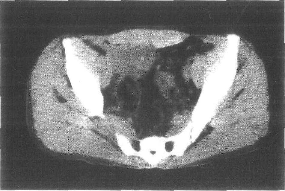 09年吉林一医生频繁听到患者发出猫叫,调查后大惊:染色体出了问题