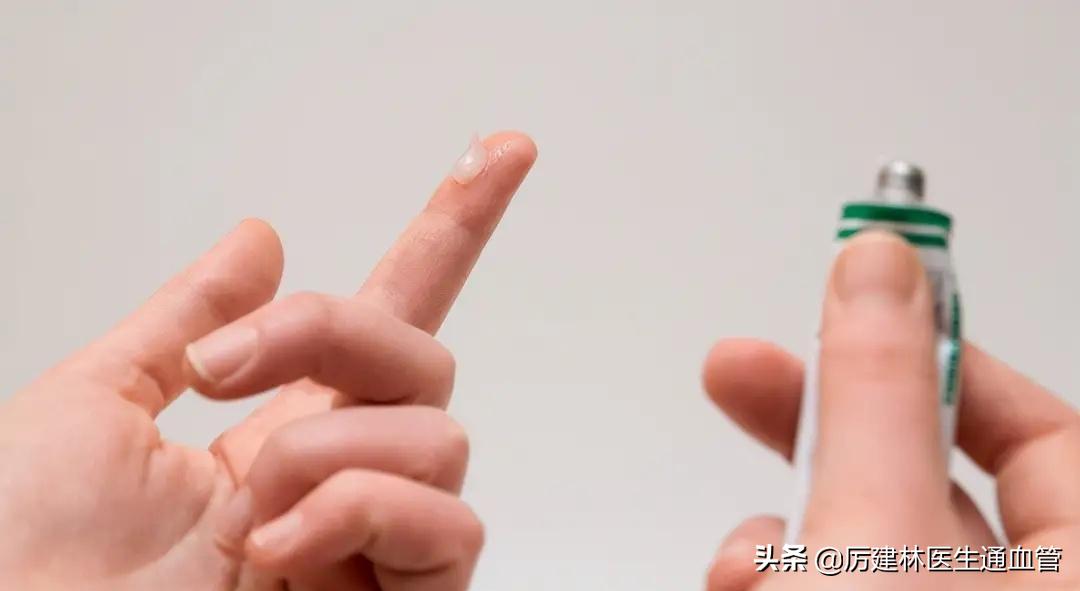 红霉素软膏和红霉素眼膏有何区别,红霉素软膏和红霉素眼膏具体区别