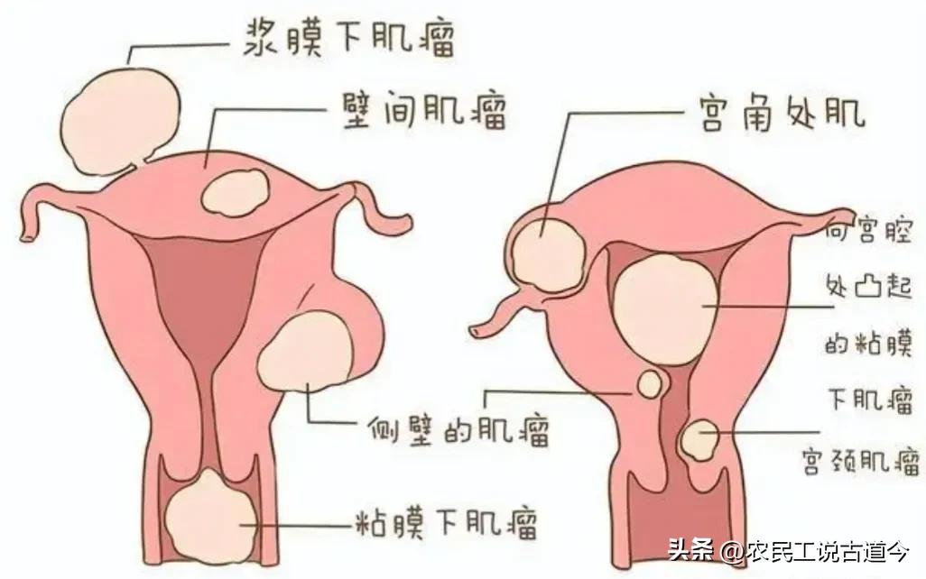 一字之差天壤之别谁编的,一字之差天壤之别意思