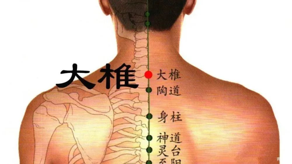 针灸治疗类风湿性关节炎,董氏针灸类风湿关节炎