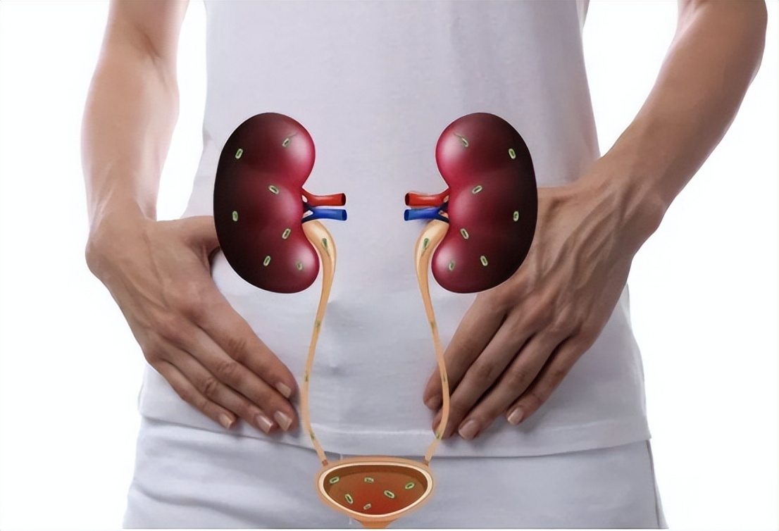 尿路感染自救方法,尿路感染怎样长期抑菌治疗