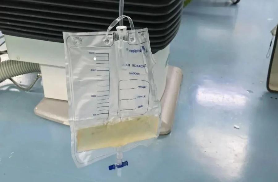 裤子脱了检查出什么问题,裤子脱到膝盖的检查