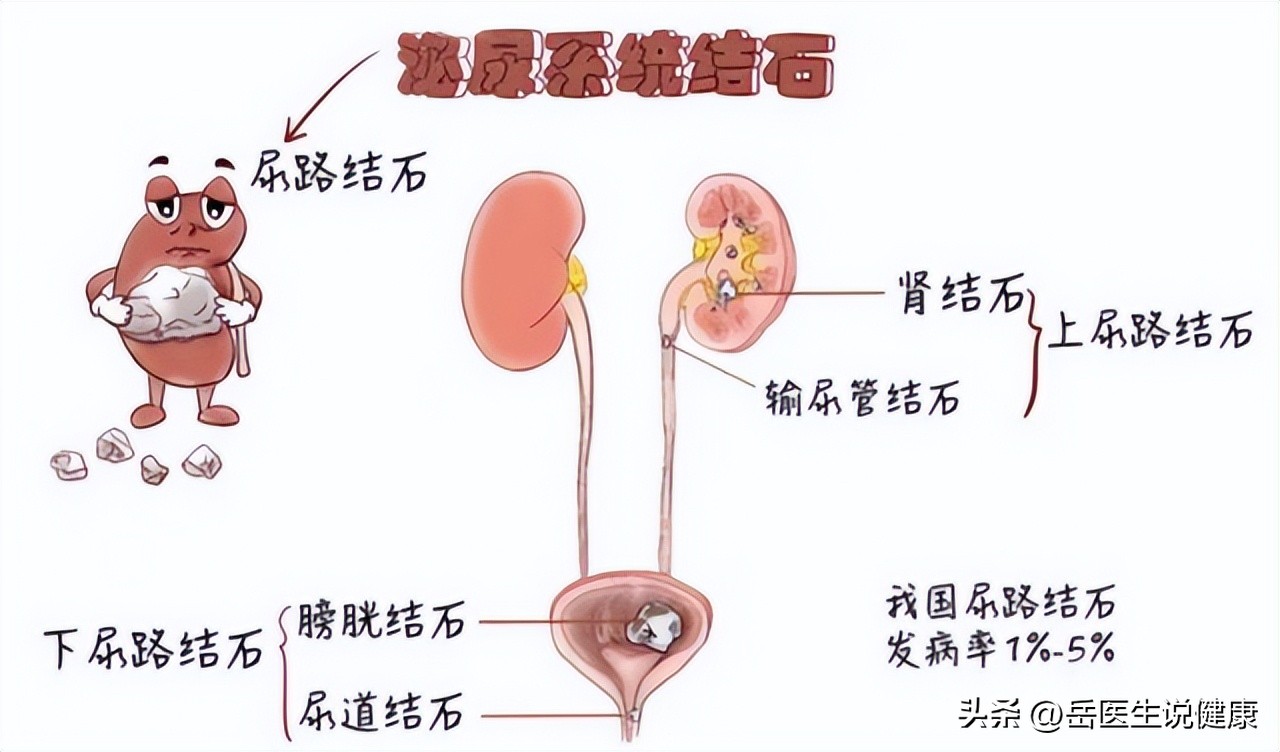 尿路感染了吃什么药,尿路感染要用什么药治疗好