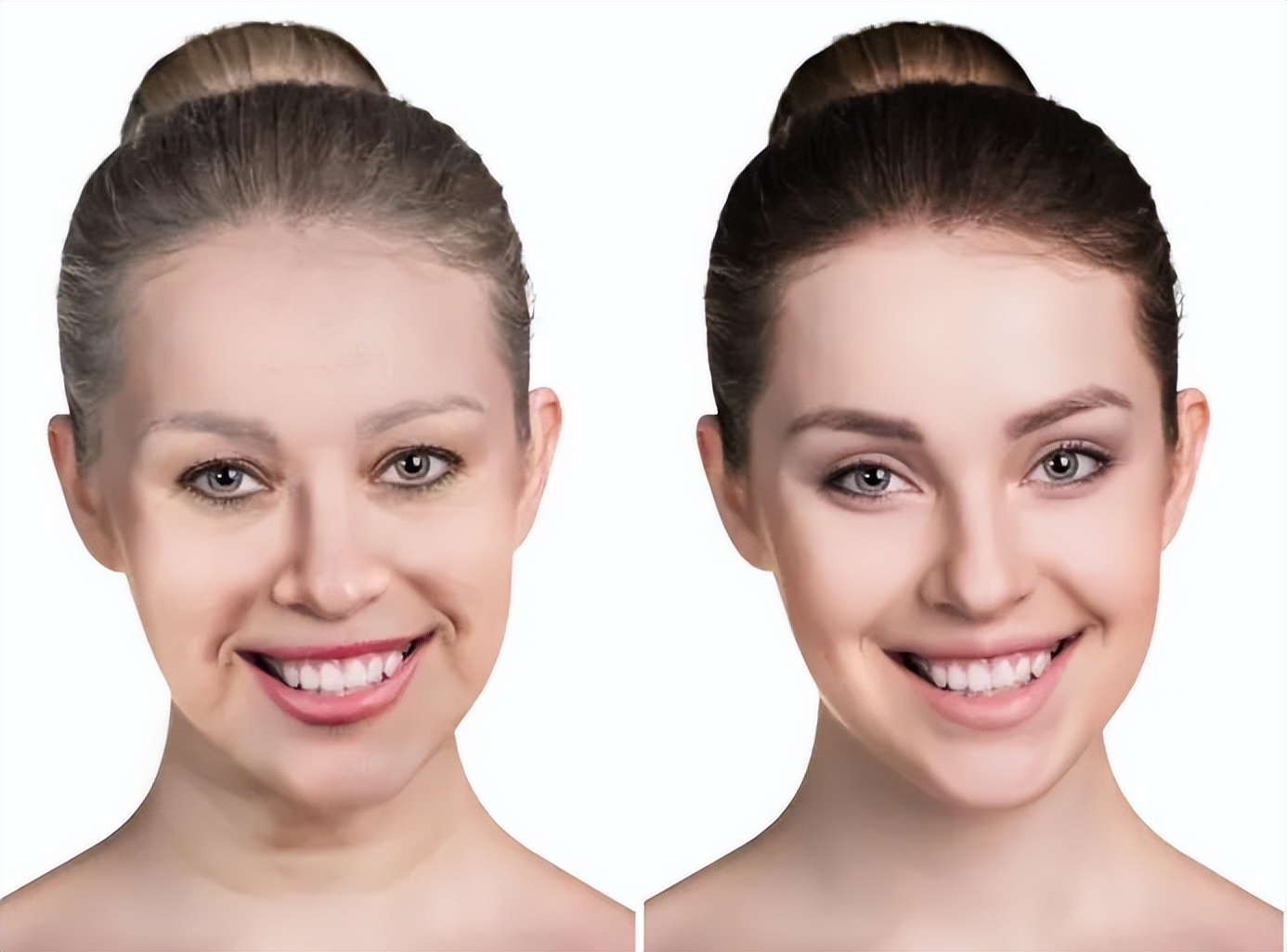 腿上毛孔堵塞有硬块怎么解决,有没有解决毛孔堵塞的身体乳