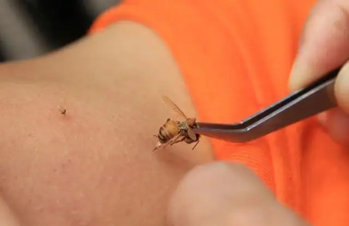 宝宝被蜜蜂蛰多久过危险期,孩子被蜜蜂蛰了怎么跟家长解释