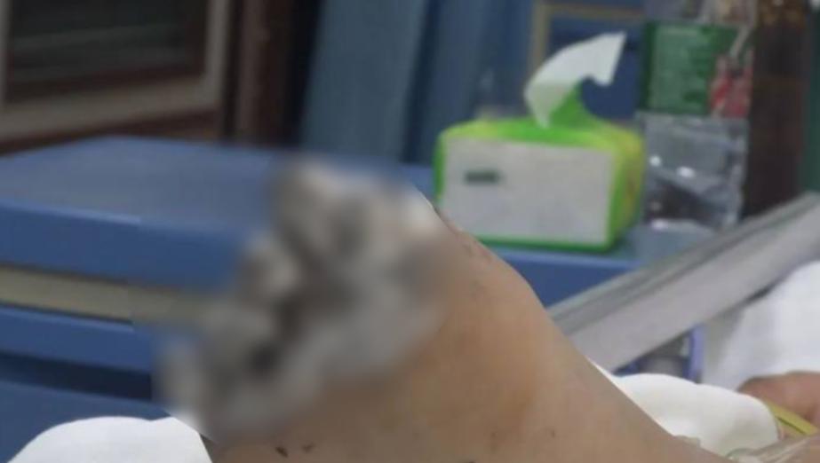 苹果回应女孩充电玩手机被电击,女孩充电时玩手机被电击苹果后续