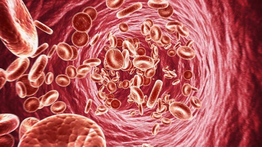 桥本甲状腺炎中医解释,中医对桥本氏甲状腺炎的认识