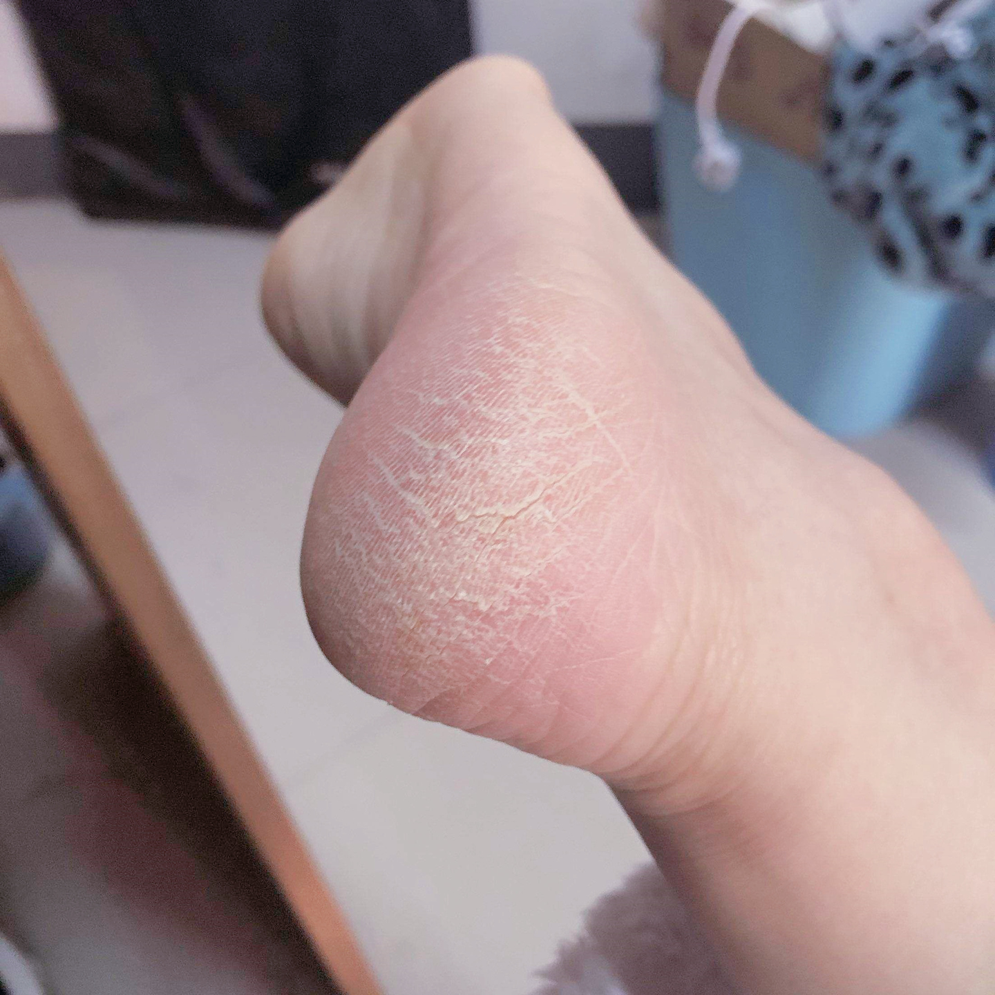 泡脚怎么保持脚的干净,怎样泡脚才能给脚泡得又白又嫩