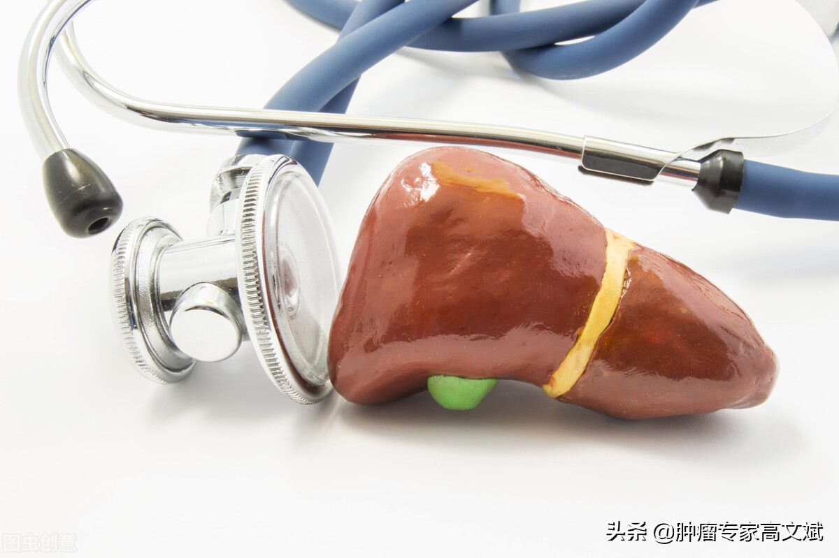 肝癌治疗方法全国有区别吗,肝癌治疗指南2021