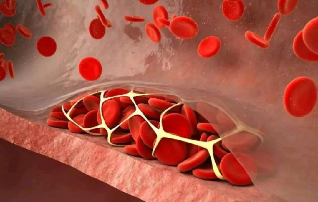 胆固醇的值是多少就危害人的健康,胆固醇正常范围之内是多少