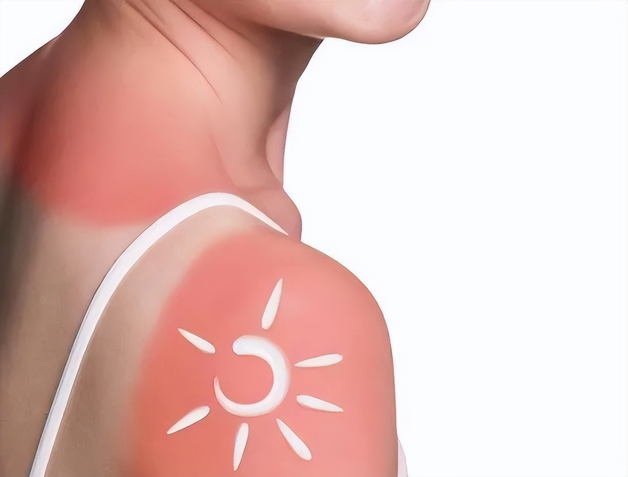 琚殜瀛愬挰鐪肩毊鍚庡彲浠ユ箍鏁峰悧,鐢ㄦ按婀挎暦铓婂瓙鍖呮秷鑲垮悧