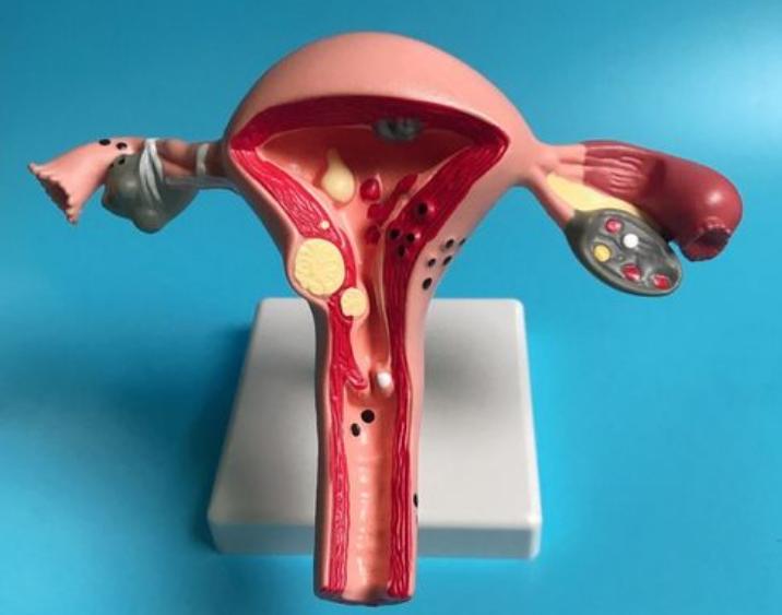 女生体检妇科有什么要注意的吗,女生体检要不要检查妇科