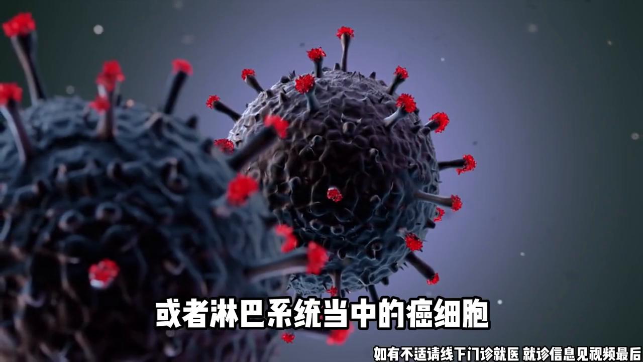 王春晖：肠癌复发时，治疗策略需要考虑多种因素