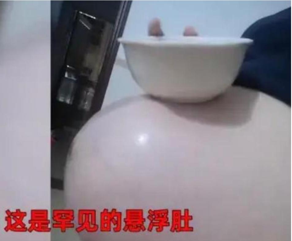 孕妈悬浮肚,孕妈露肚子晒太阳鼓包