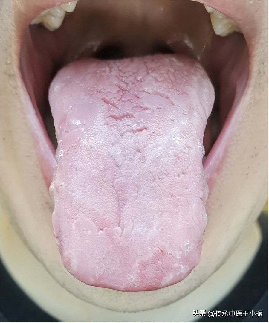 肾阳虚艾灸哪个穴位最好最有效,肾阳虚怕冷的最佳治疗方法