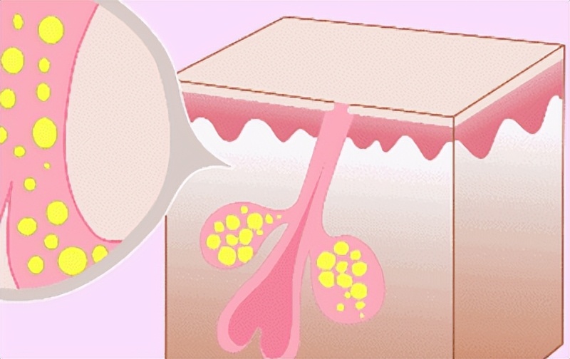 缩小毛孔7个实用方法小技巧,缩小毛孔的最好方法