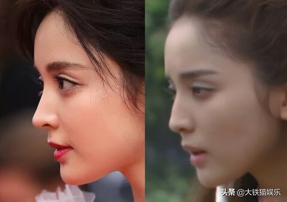 哪个女明星鼻子难看,鼻子最难看的十大女明星