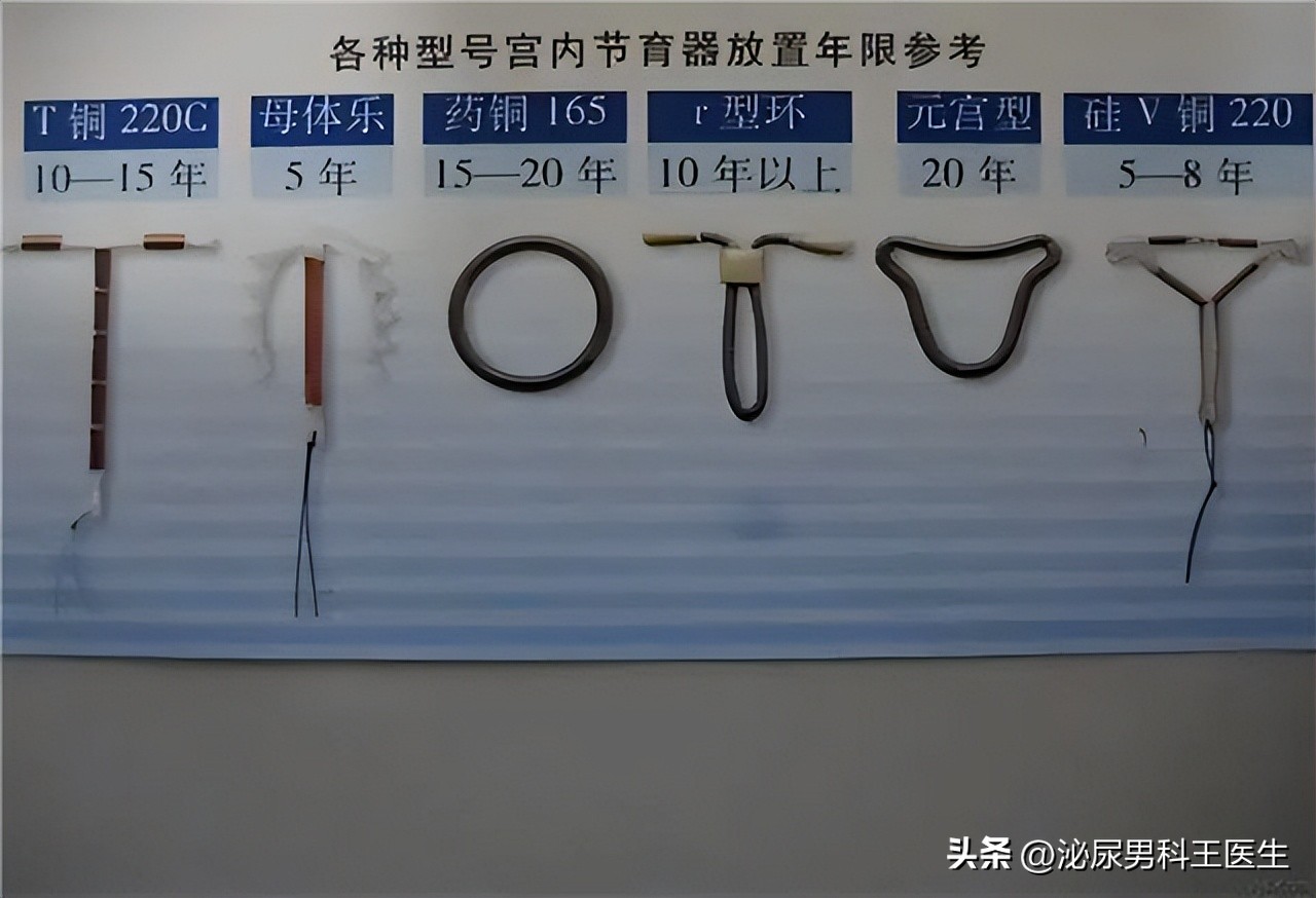 节育环多大年龄取出好取,节育环一直不摘
