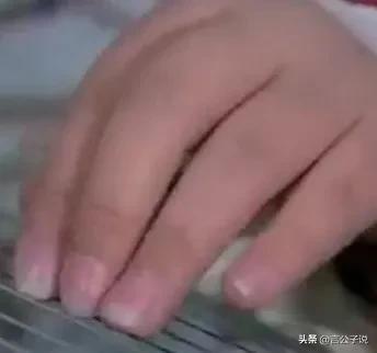 “小丑手”太减分了，这7位女星个个貌美如花，却被手拖后腿