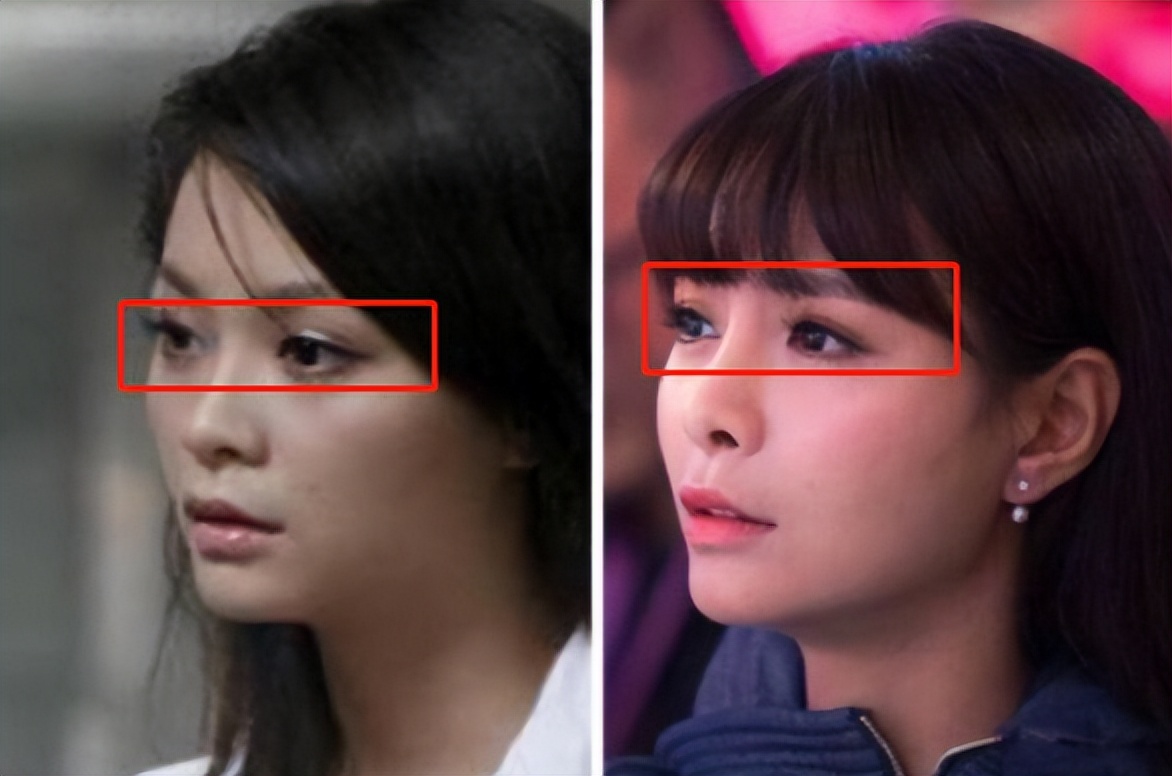 这些整容后都逆袭的女明星,盘点全网那些整容失败的女明星