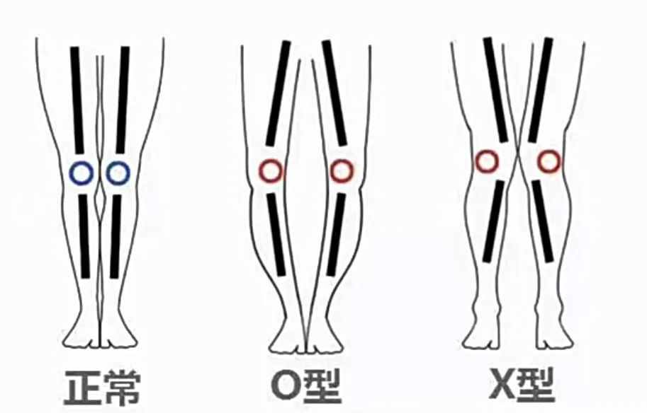 看起来胖实际没多重,胖有可能也是营养不良图文