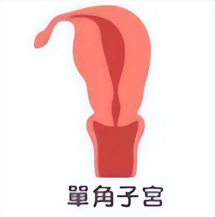 七种子宫形状，你了解过吗？