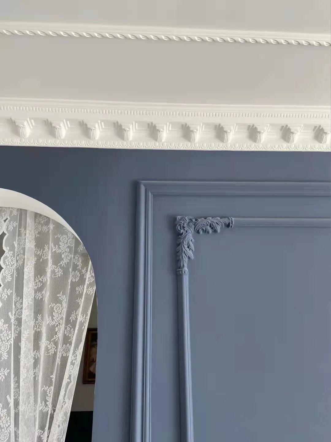 石膏线落伍吗,石膏线为什么不流行了