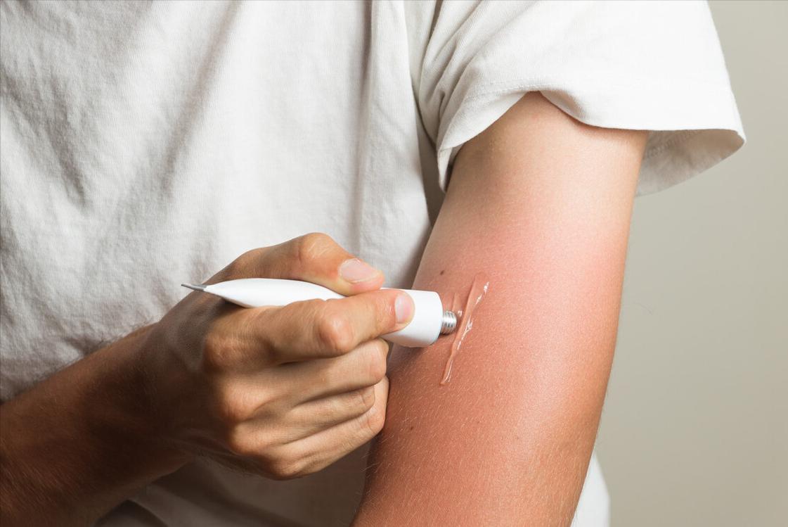 红霉素软膏抹脸上会变白吗,红霉素软膏可以擦眼下吗