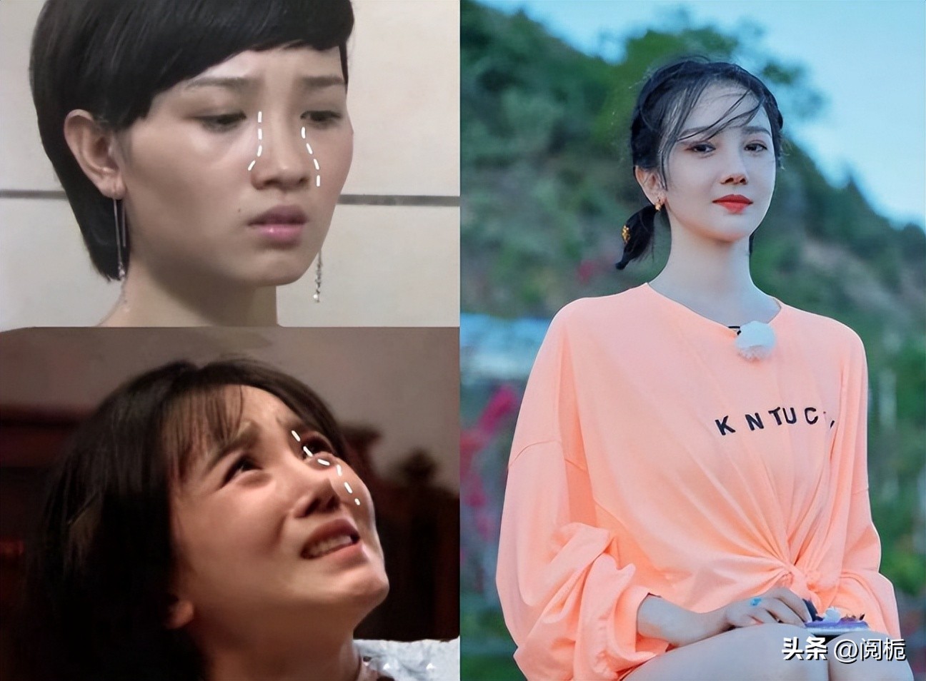 靠换脸逆天改命的六位女星,长得歪瓜裂枣整得美若天仙的明星