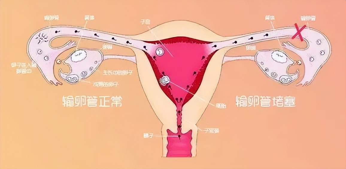 十堰市人民医院输卵管造影技术,江苏省人民医院做输卵管造影