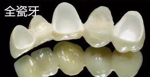 全瓷牙和烤瓷牙相比哪个更结实,全瓷牙和烤瓷牙哪个质量好一点