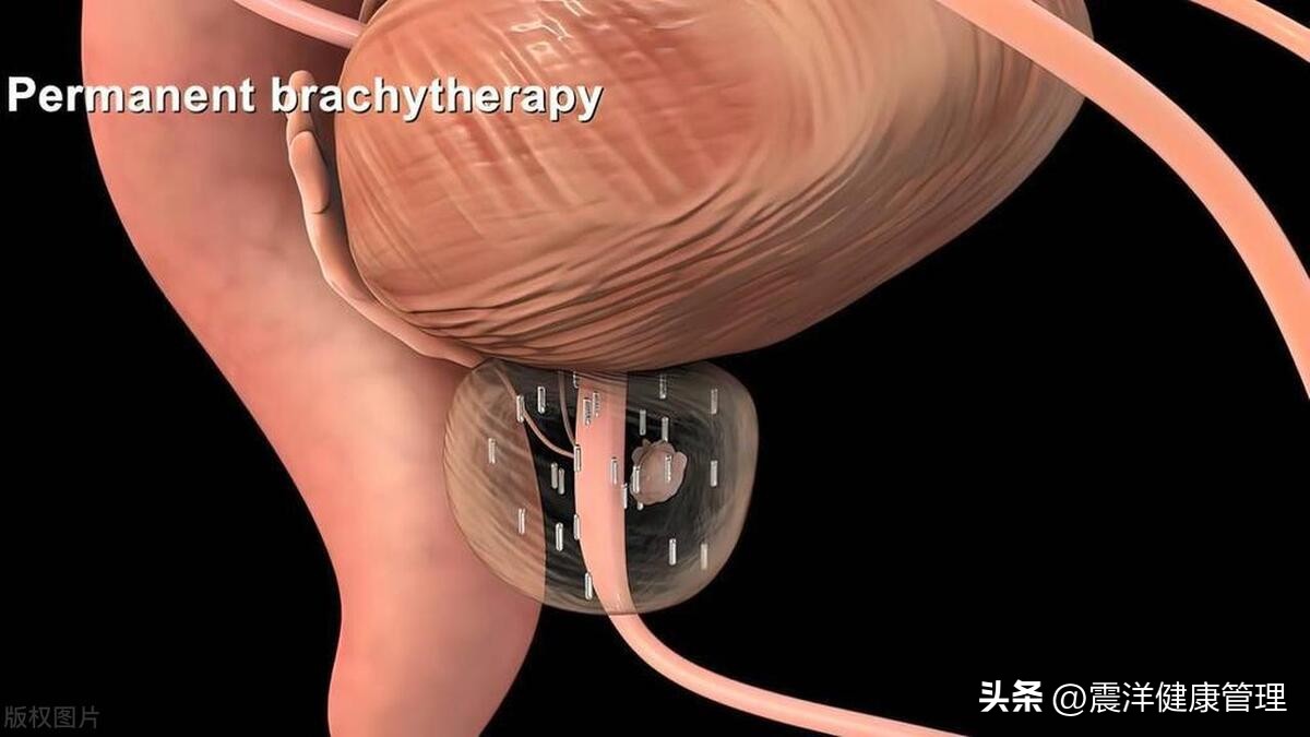 在私人影院，男友突然来了感觉，我慌忙中踢中他的蛋蛋，痛了整天