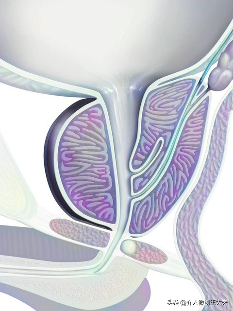 超声解读前列腺增生与肥大,前列腺增生超声改变是怎么回事