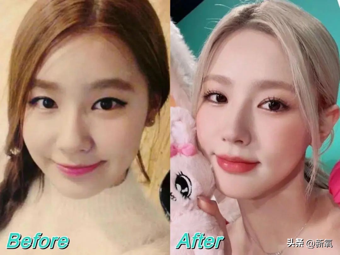 改一点赢很大？她整完鼻子直接美成断代神颜…