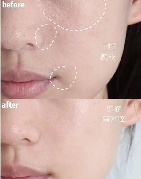 ahc神仙水乳套装适合红血丝吗,ahc神仙水乳怎么辨别真假