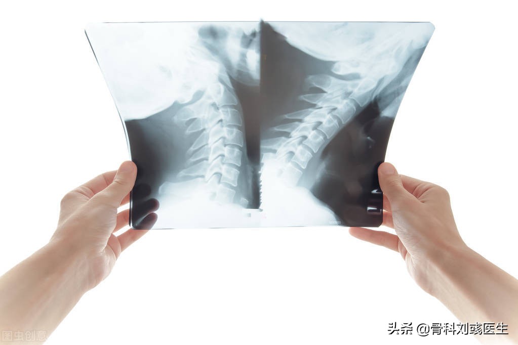 颈椎病引起头晕犯困,颈椎病引起胸闷头晕