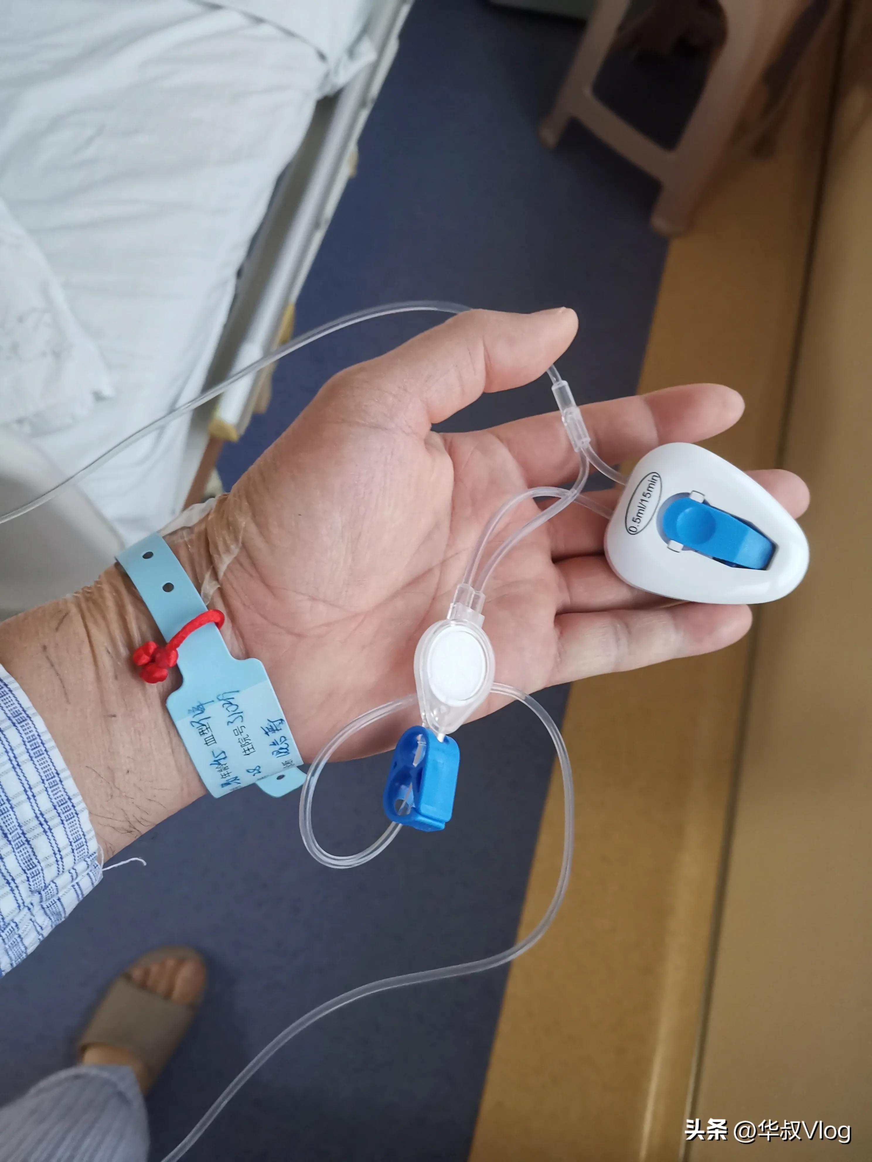 ????说说痔疮切除过程的感受！