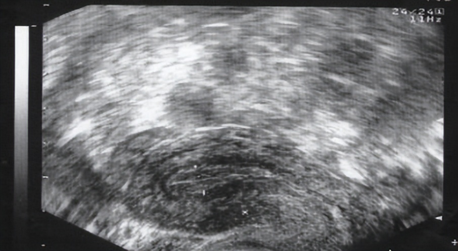 监测排卵，帮你抓住好“孕”~