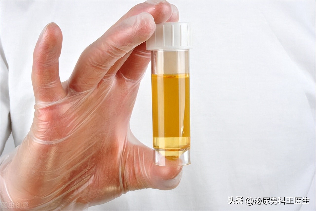 拉小便总是分叉男性,男性小便分叉怎么治疗